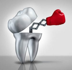 Fluoride Natures Cavity Fighter