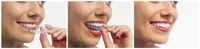 Three photos showing the ease of using Invisalign clear aligner appliances